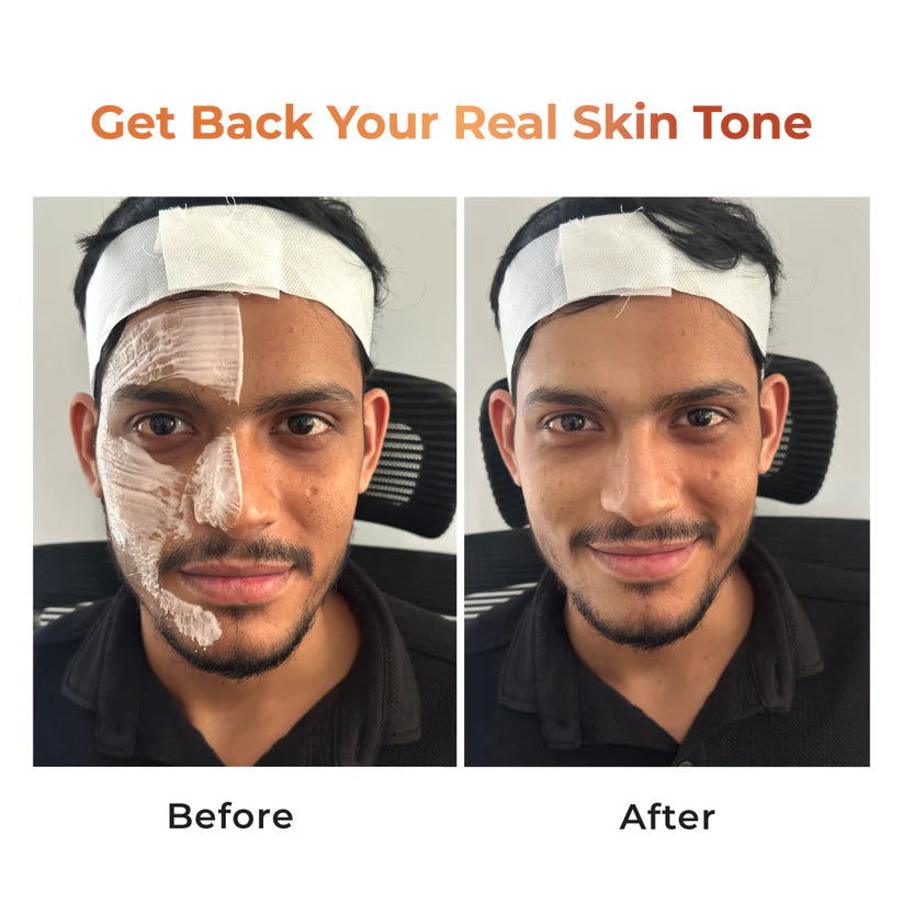 Niconi Tan Vanish Gluta-Kojic Skin Polish 180g (₹80 per use)