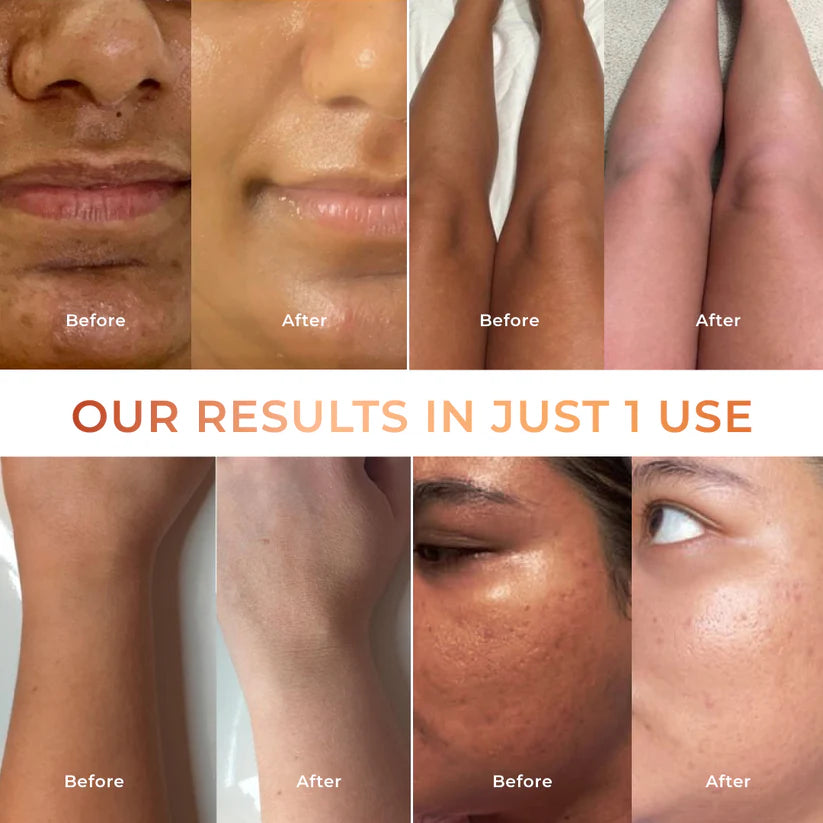 Niconi Tan Vanish Gluta-Kojic Skin Polish 180g (₹80 per use)